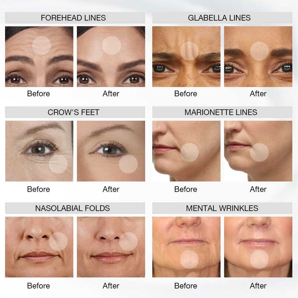 Premium 4 Color LED Light Therapy Mask – Red & Infrared Anti-Aging Silicone Photon Mask, Flexible & Soft Design for Face 