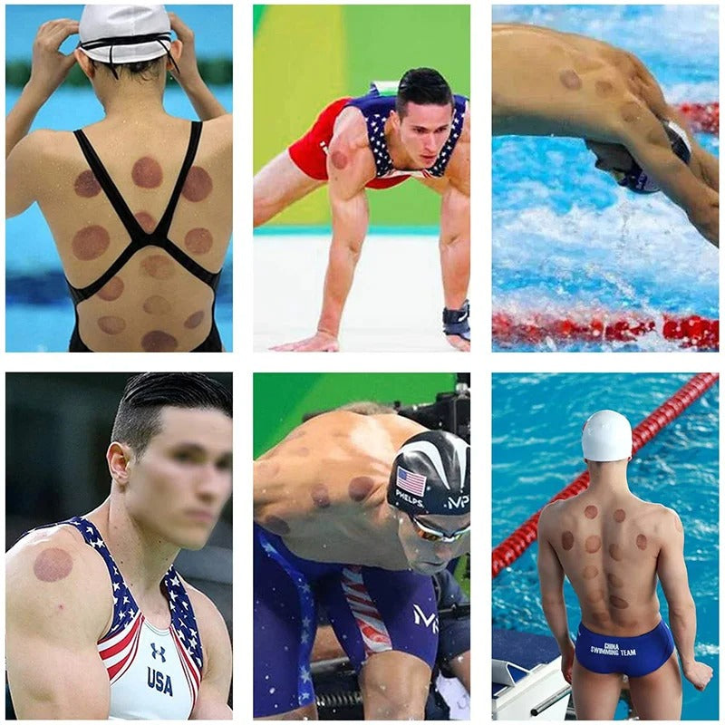 Premium Vacuum Cupping Therapy Set – 6, 12, or 24 Plastic Suction Cups for Massage, Relaxing Muscles, Pain Relief, and Well-Being, Safe Alternative to Traditional Cupping, Durable Quality - StrengthXPhysiotherapy