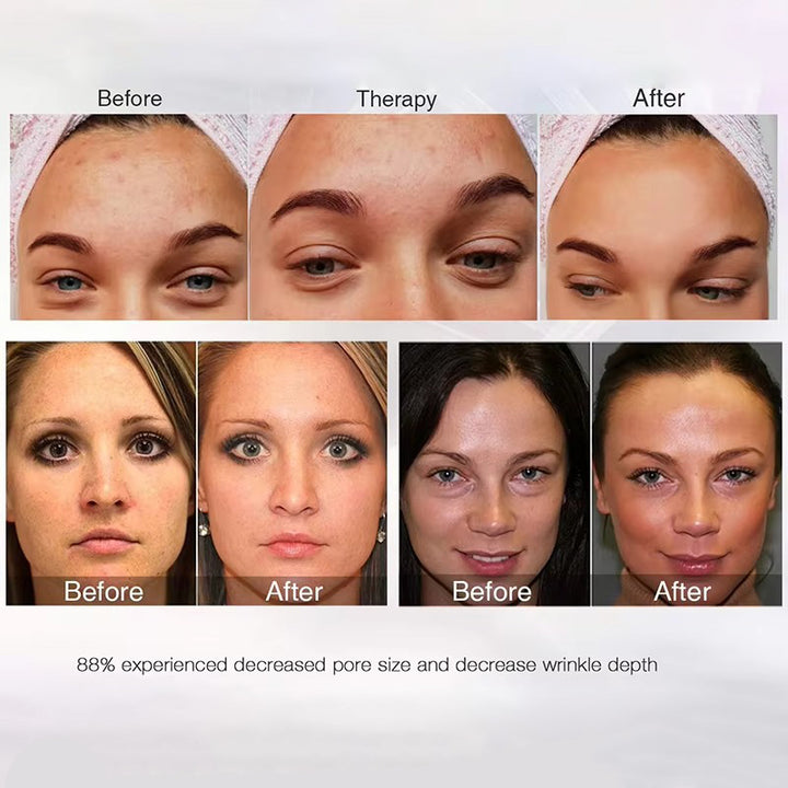 Premium LED Facial and Neck Rejuvenation Machine – Skin Rejuvenation Massager for Anti-Aging, Wrinkle Reduction, and Skin Tightening with Advanced Light Therapy - StrengthXPhysiotherapy