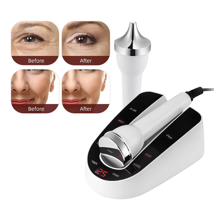 Premium Ultrasound Beauty Machine – High Frequency Face and Eye Massager for Skin Care, Facial Lifting, and SPA-Grade Ultrasonic Cleansing Device - StrengthXPhysiotherapy