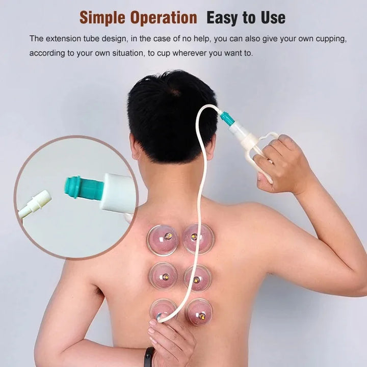 Premium Cupping Therapy Set – Professional Vacuum Suction Cups for Chinese Medicine Physiotherapy, Massage, and Muscle Relaxation, Durable Plastic Jars for Home and Professional Use - StrengthXPhysiotherapy